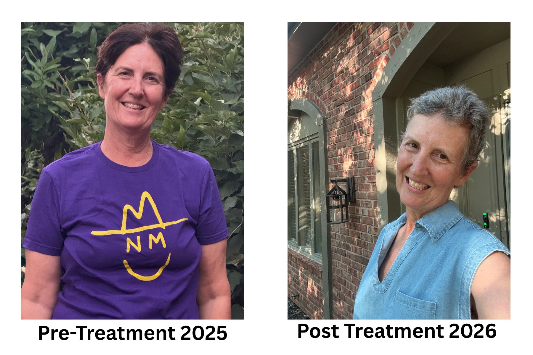 Before and after cancer treatment comparison - Pre-Treatment 2025 and Post Treatment 2026 - 10minutesermons.com
